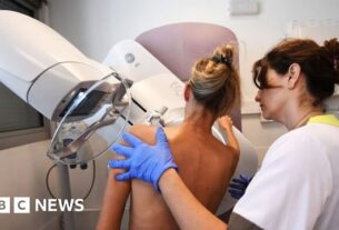 male-workers-should-be-able-to-carry-out-mammograms,-experts-say