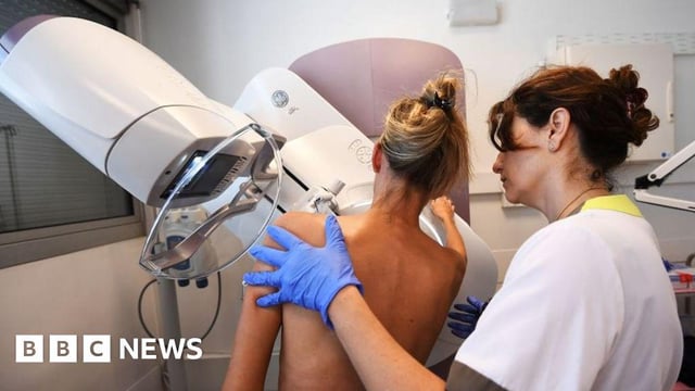 male-workers-should-be-able-to-carry-out-mammograms,-experts-say